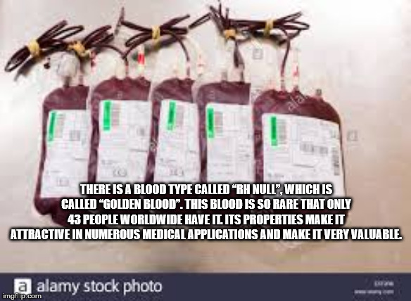 There Is A Blood Type Called Rh Null". Which Is Called "Golden Blood". This Blood Is So Rare That Only 43 People Worldwide Have Il Its Properties Make It Attractive In Numerous Medical Applications And Make It Very Valuable. a alamy stock photo imgflip.co