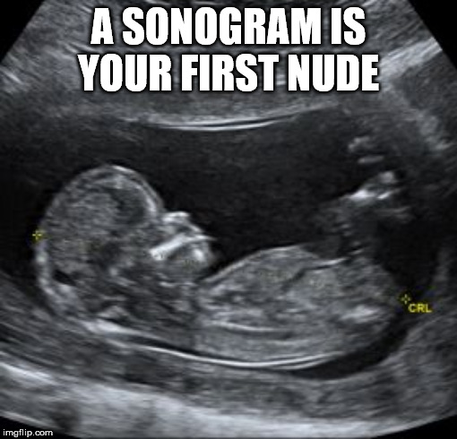 pregnancy post prank - A Sonogram Is Your First Nude imgflip.com
