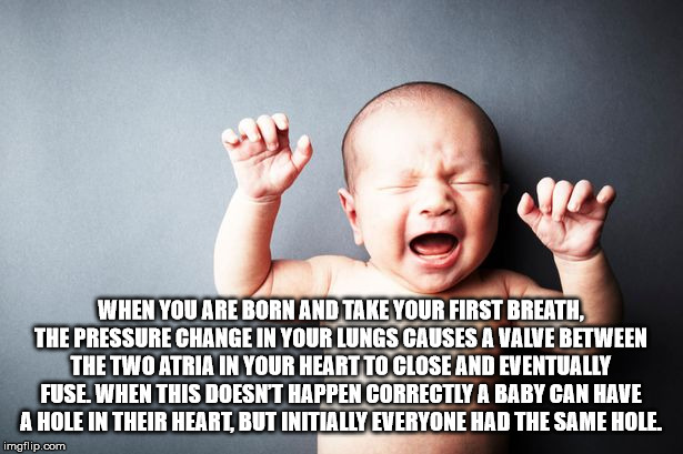 photo caption - When You Are Born And Take Your First Breath. The Pressure Change In Your Lungs Causes A Valve Between The Two Atria In Your Heart To Close And Eventually Fuse. When This Doesn'T Happen Correctly A Baby Can Have A Hole In Their Heart, But 