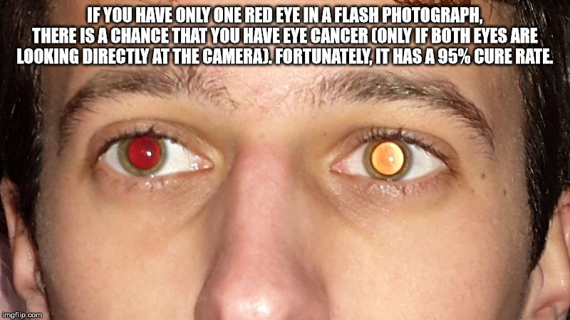 close up - If You Have Only One Red Eye In A Flash Photograph. There Is A Chance That You Have Eye Cancer Only If Both Eyes Are Looking Directly At The Camerad. Fortunately. It Has A 95% Cure Rate, imgflip.com