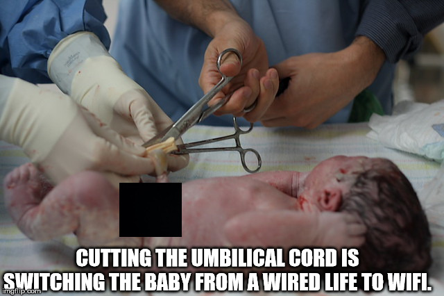 Cutting The Umbilical Cord Is Switching The Baby From A Wired Life To Wifi.