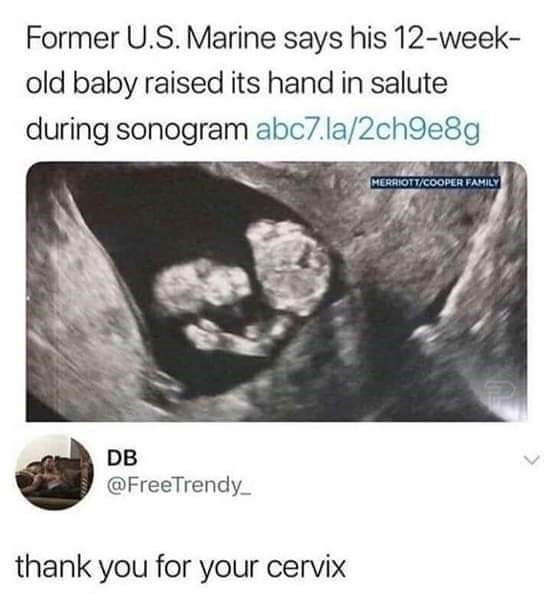 thank you for your cervix meme - Former U.S. Marine says his 12week old baby raised its hand in salute during sonogram abc7.la2ch9e8g MerriottCooper Family Db thank you for your cervix