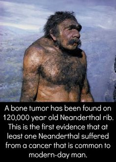 homo neanderthalensis - A bone tumor has been found on 120,000 year old Neanderthal rib. This is the first evidence that at least one Neanderthal suffered from a cancer that is common to modernday man.