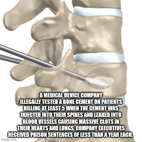 A Medical Device Company Illegally Tested A Bone Cement On Patients Killing At Least 5 When The Cement Was Injected Into Their Spines And Leaked Into Blood Vessels Causing Massive Clots In Their Hearts And Lungs. Company Executives Received Prison…