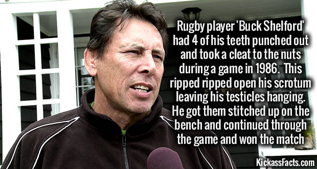 buck shelford injury - Rugby player 'Buck Shelford had 4 of his teeth punched out and took a cleat to the nuts during a game in 1986. This ripped ripped open his scrotum leaving his testicles hanging. He got them stitched up on the bench and continued thr