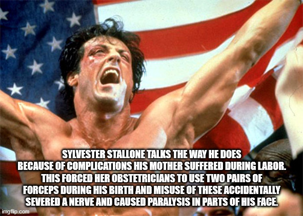 rocky balboa - Sylvester Stallone Talks The Way He Does Because Of Complications His Mother Suffered During Labor. This Forced Her Obstetricians To Use Two Pairs Of Forceps During His Birth And Misuse Of These Accidentally Severed A Nerve And Caused Paral