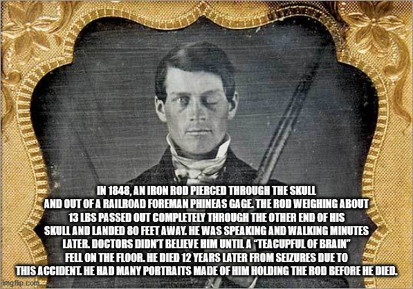 phineas gage meme - In 1848, An Iron Rod Pierced Through The Skull And Out Of A Railroad Foreman Phineas Gage. The Rod Weighing About 13 Lbs Passed Out Completely Through The Other End Of His Skull And Landed 80 Feet Away. He Was Speaking And Walking minu