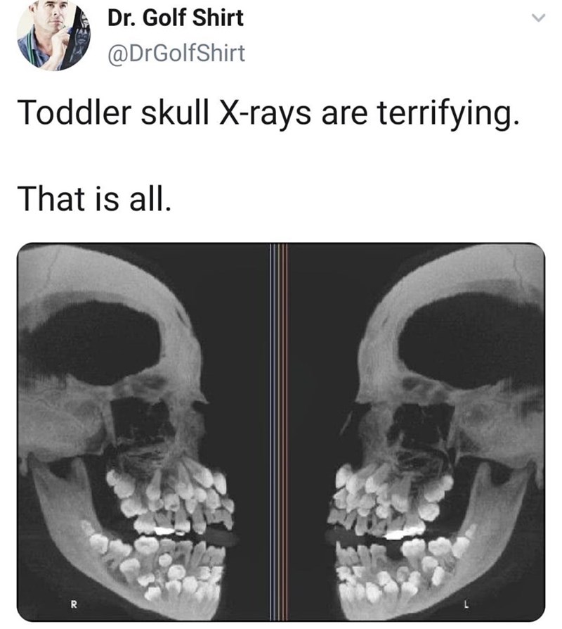 x ray of a baby's head - Dr. Golf Shirt Toddler skull Xrays are terrifying. That is all.