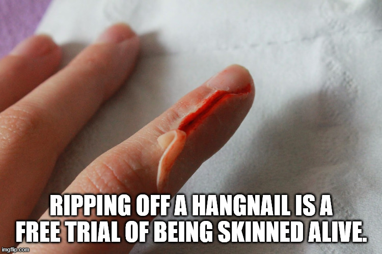 โลโก้ กลุ่ม ksr - Ripping Off A Hangnail Is A Free Trial Of Being Skinned Alive. imgflip.com