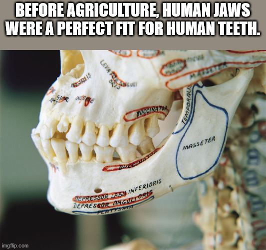 jaw - Depressor Anguitoris Depressor Lebl Inferioris Before Agriculture, Human Jaws Were A Perfect Fit For Human Teeth. Levatos Mais > Temporalis Buccinator Masse Ter imgflip.com