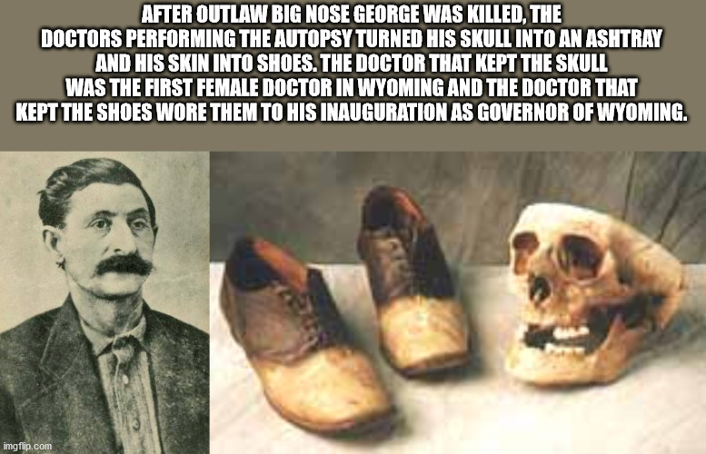 big nose george - After Outlaw Big Nose George Was Killed, The Doctors Performing The Autopsy Turned His Skull Into An Ashtray And His Skin Into Shoes. The Doctor That Kept The Skull Was The First Female Doctor In Wyoming And The Doctor That Kept The Shoe