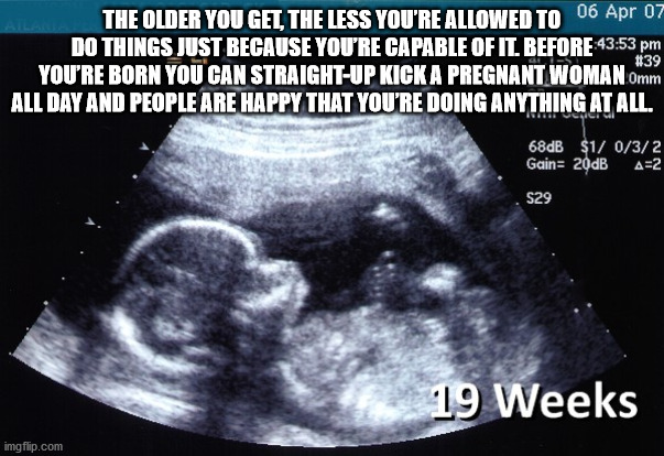 radiology - The Older You Get, The Less You'Re Allowed To 06 Apr 07 Do Things Just Because You'Re Capable Of It Before You'Re Born You Can StraightUp Kick A Pregnant Woman Omm All Day And People Are Happy That You'Re Doing Anything At All. Iteite Cctv 68d