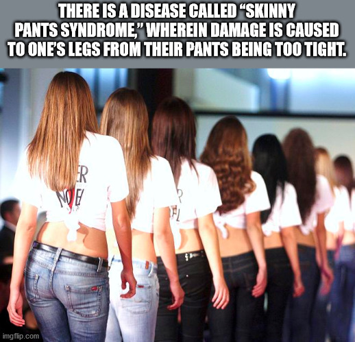 girl - There Is A Disease Called Skinny Pants Syndrome" Wherein Damage Is Caused To One'S Legs From Their Pants Being Too Tight. Er Ne imgflip.com