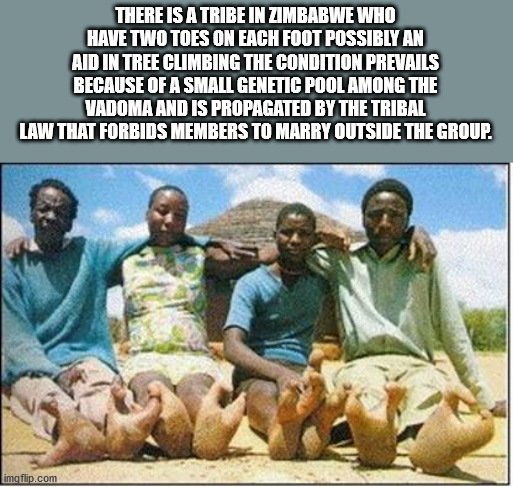 vadoma tribe - There Is A Tribe In Zimbabwe Who Have Two Toes On Each Foot Possibly An Aid In Tree Climbing The Condition Prevails Because Of A Small Genetic Pool Among The Vadoma And Is Propagated By The Tribal Law That Forbids Members To Marry Outside T