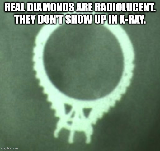 not sure if joking - Real Diamonds Are Radiolucent. They Don'T Show Up In XRay. imgflip.com