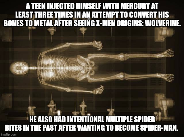 darkness - A Teen Injected Himself With Mercury At Least Three Times In An Attempt To Convert His Bones To Metal After Seeing XMen Origins Wolverine. He Also Had Intentional Multiple Spider Bites In The Past After Wanting To Become SpiderMan. imgflip.com