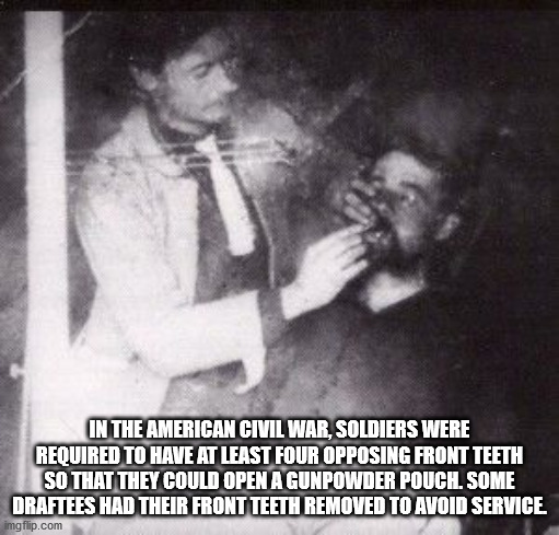 civil war dentist - In The American Civil War, Soldiers Were Required To Have At Least Four Opposing Front Teeth So That They Could Open A Gunpowder Pouch. Some Draftees Had Their Front Teeth Removed To Avoid Service imgflip.com