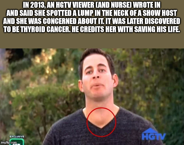 tarek el moussa cancers - In 2013, An Hgtv Viewer Cand Nurse Wrote In And Said She Spotted A Lump In The Neck Of A Show Host And She Was Concerned About It. It Was Later Discovered To Be Thyroid Cancer. He Credits Her With Saving His Life. Exclusive imgfl