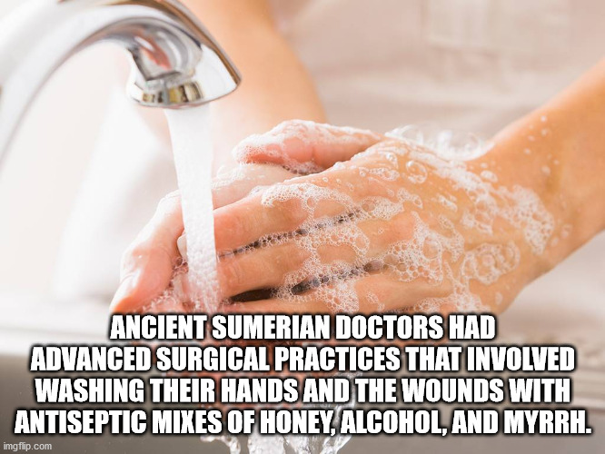 hand - Ancient Sumerian Doctors Had Advanced Surgical Practices That Involved Washing Their Hands And The Wounds With Antiseptic Mixes Of Honey, Alcohol, And Myrrh. imgflip.com