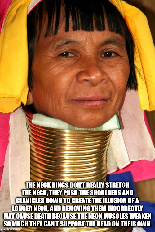 tribe - The Neck Rings Dont Really Stretch The Neck, They Push The Shoulders And Clavicles Down To Create The Illusion Of A Longer Neck, And Removing Them Incorrectly May Cause Death Because The Neck Muscles Weaken So Much They Can'T Support The Head On T