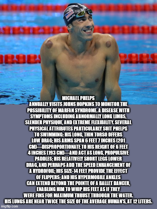 cupping therapy - Melps Michael Phelps Annually Visits Johns Hopkins To Monitor The Possibility Of Marfan Syndrome. A Disease With Symptoms Including Abnormally Long Limbs, Slender Physique, And Extreme Flexibility. Several Physical Attributes Particularl