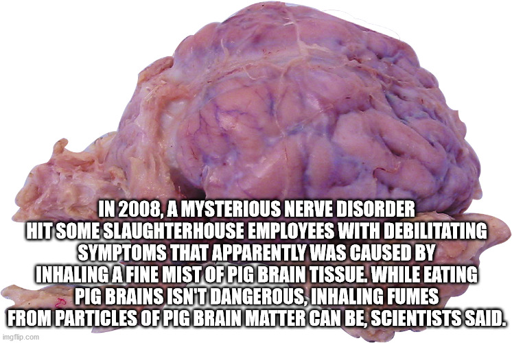 skip bayless meme - In 2008, A Mysterious Nerve Disorder Hit Some Slaughterhouse Employees With Debilitating Symptoms That Apparently Was Caused By Inhaling A Fine Mist Of Pig Brain Tissue. While Eating Pig Brains Isn'T Dangerous, Inhaling Fumes From Part