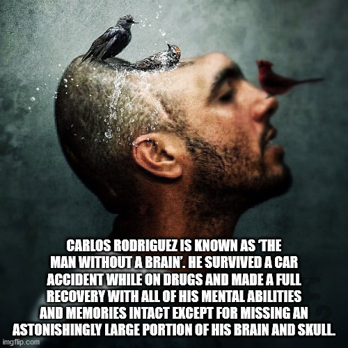 album cover - Carlos Rodriguez Is Known As The Man Without A Brain'. He Survived A Car Accident While On Drugs And Made A Full Recovery With All Of His Mental Abilities And Memories Intact Except For Missing An Astonishingly Large Portion Of His Brain And