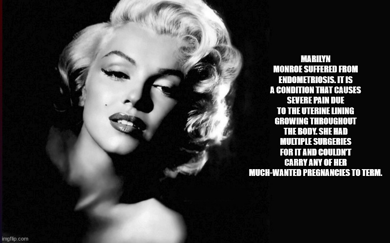 marilyn monroe - Marilyn Monroe Suffered From Endometriosis. It Is A Condition That Causes Severe Pain Due To The Uterine Lining Growing Throughout The Body. She Had Multiple Surgeries For It And Couldn'T Carry Any Of Her MuchWanted Pregnancies To Term. i