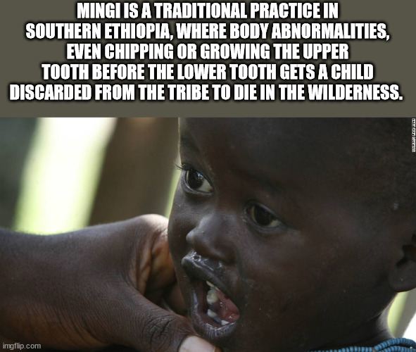 untitled \"last time\" - Mingi Is A Traditional Practice In Southern Ethiopia, Where Body Abnormalities, Even Chipping Or Growing The Upper Tooth Before The Lower Tooth Gets A Child Discarded From The Tribe To Die In The Wilderness. imgflip.com
