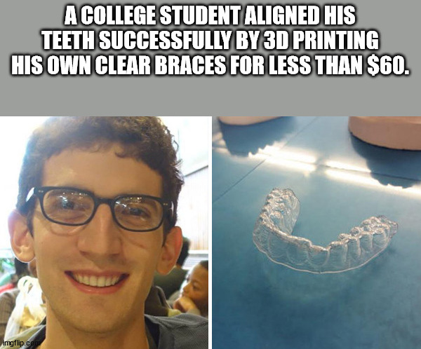 cool facts - invisalign in college - A College Student Aligned His Teeth Successfully By 3D Printing His Own Clear Braces For Less Than $60. imgflip.com