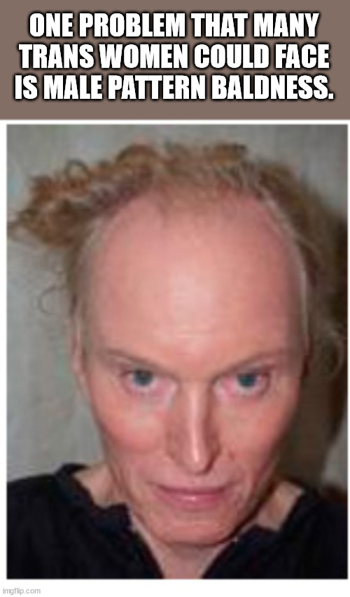 hairstyle - One Problem That Many Trans Women Could Face Is Male Pattern Baldness imgflip.com