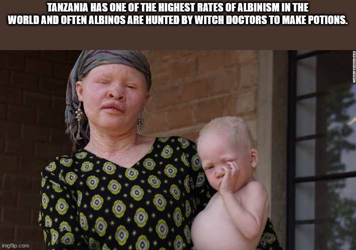 photo caption - Tanzania Has One Of The Highest Rates Of Albinism In The World And Often Albinos Are Hunted By Witch Doctors To Make Potions. Attende c 0 0 O 0 0 . Ste 0 imgflip.com 2