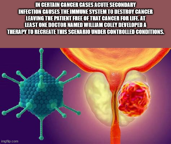 Prostate - In Certain Cancer Cases Acute Secondary Infection Causes The Immune System To Destroy Cancer Leaving The Patient Free Of That Cancer For Ufe. At Least One Doctor Named William Coley Developed A Therapy To Recreate This Scenario Under Controlled