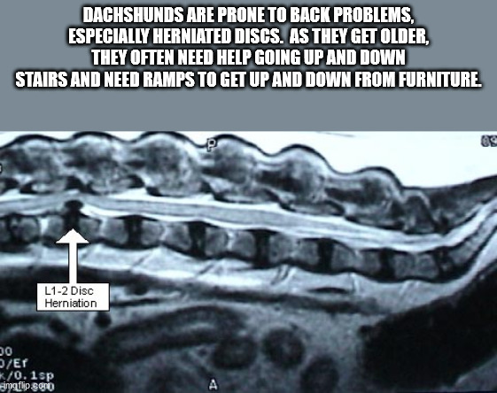 fun facts - interesting facts - jaw - Dachshunds Are Prone To Back Problems, Especially Herniated Discs. As They Get Older, They Often Need Help Going Up And Down Stairs And Need Ramps To Get Up And Down From Furniture L12 Disc Herniation 20 Er K0.1sp img