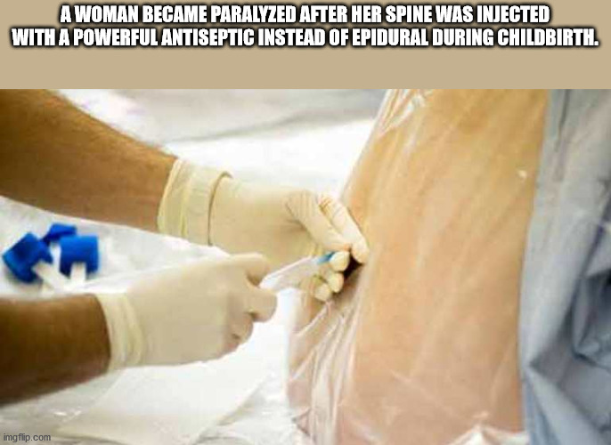 A Woman Became Paralyzed After Her Spine Was Injected With A Powerful Antiseptic Instead Of Epidural During Childbirth. imgflip.com