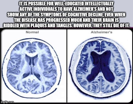 Knowledge Nuggets For Your Dendrites to Dine On