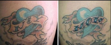 Funny Tattoo Cover Ups