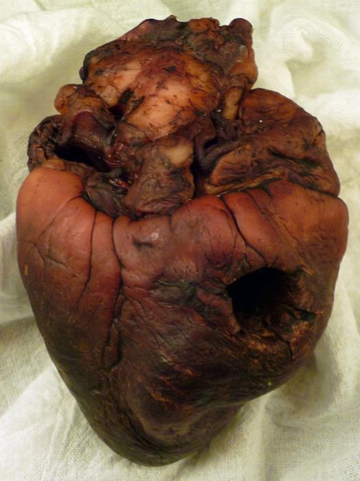 Mummified Vampire Heart For Sale on Ebay