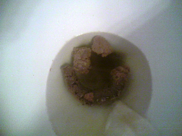 This is a smiley face of shit I made