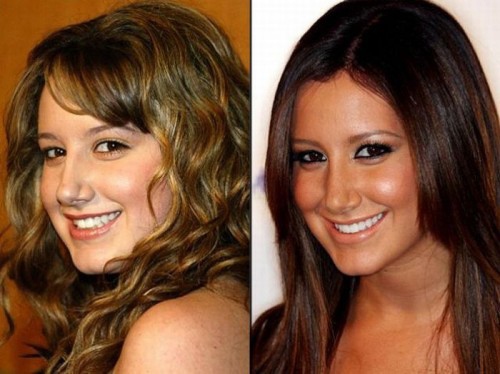 25 Celebrities Before And After Fame