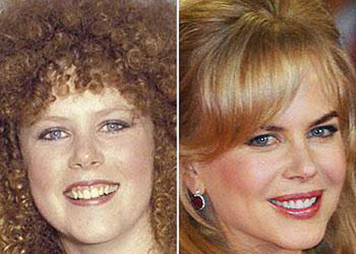 25 Celebrities Before And After Fame