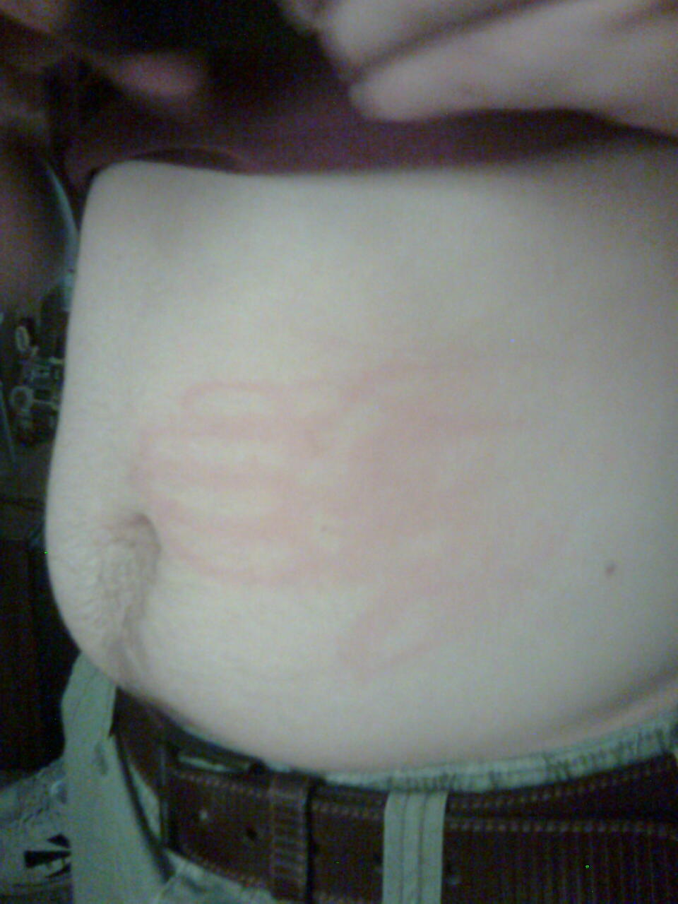 My friend was laying down with his shirt pulled up, so I slapped his stomach as hard as I could.  It left a perfect impression of my hand.  haha!
