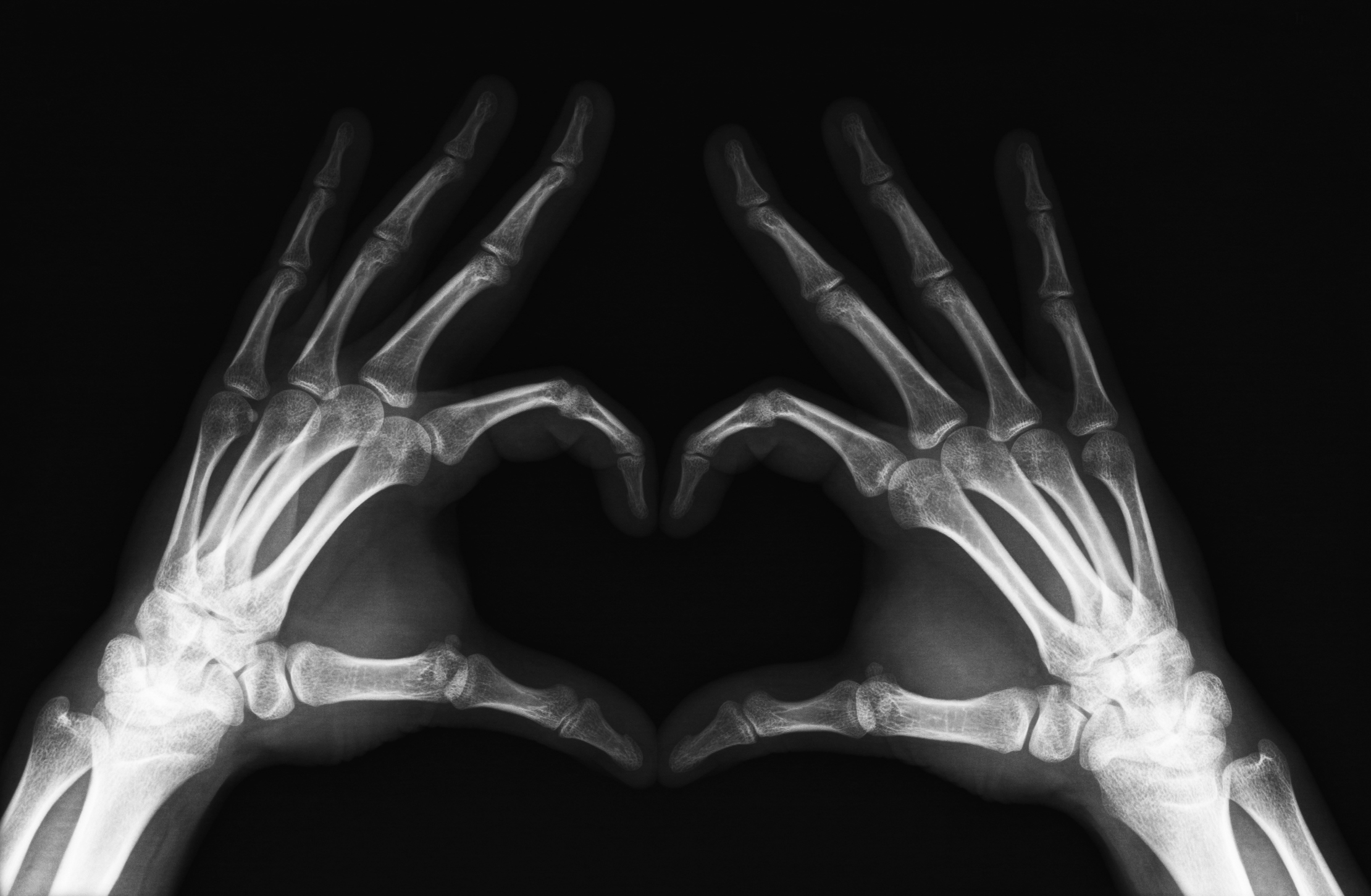X-Ray Art.