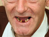 Iraq War veteran Ian Boynton could not afford to go private for treatment so instead took the drastic action to remove 13 of his teeth that were giving him severe pain. The 42-year-old, from Beverley, East Yorkshire, had not had his teeth looked at since seeing the army dentist in 2003.