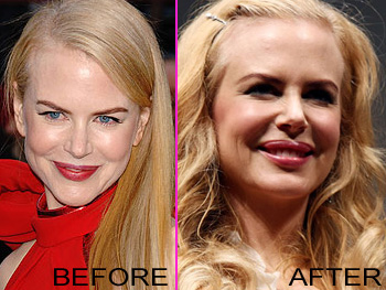 Effects Of Plastic Surgery.