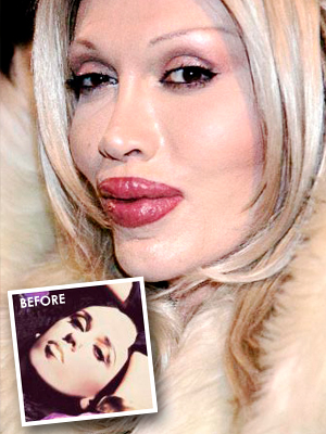 Effects Of Plastic Surgery.