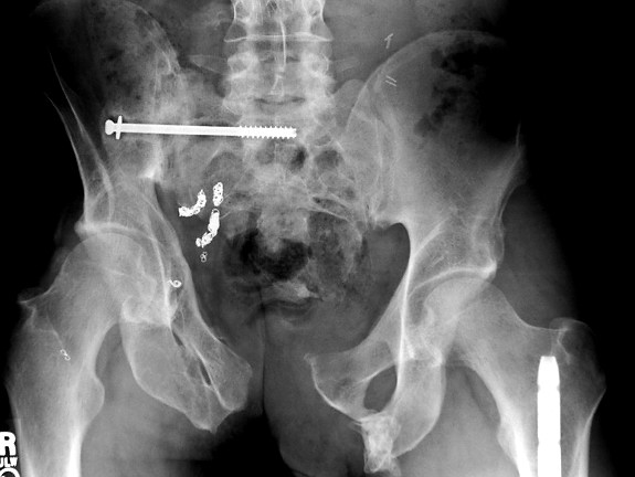 Amazing X-rays