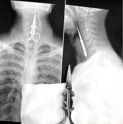 Amazing X-rays