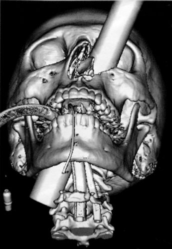 Amazing X-rays