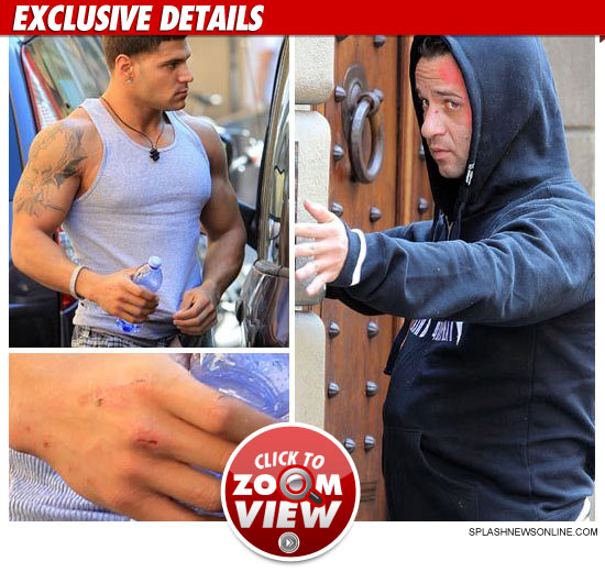 Ronnie and The Situation got into a MAJOR fist fight with each other last night in Italy ... TMZ has learned -- and based on the post-brawl pictures ... the Sitch got his ass kicked.